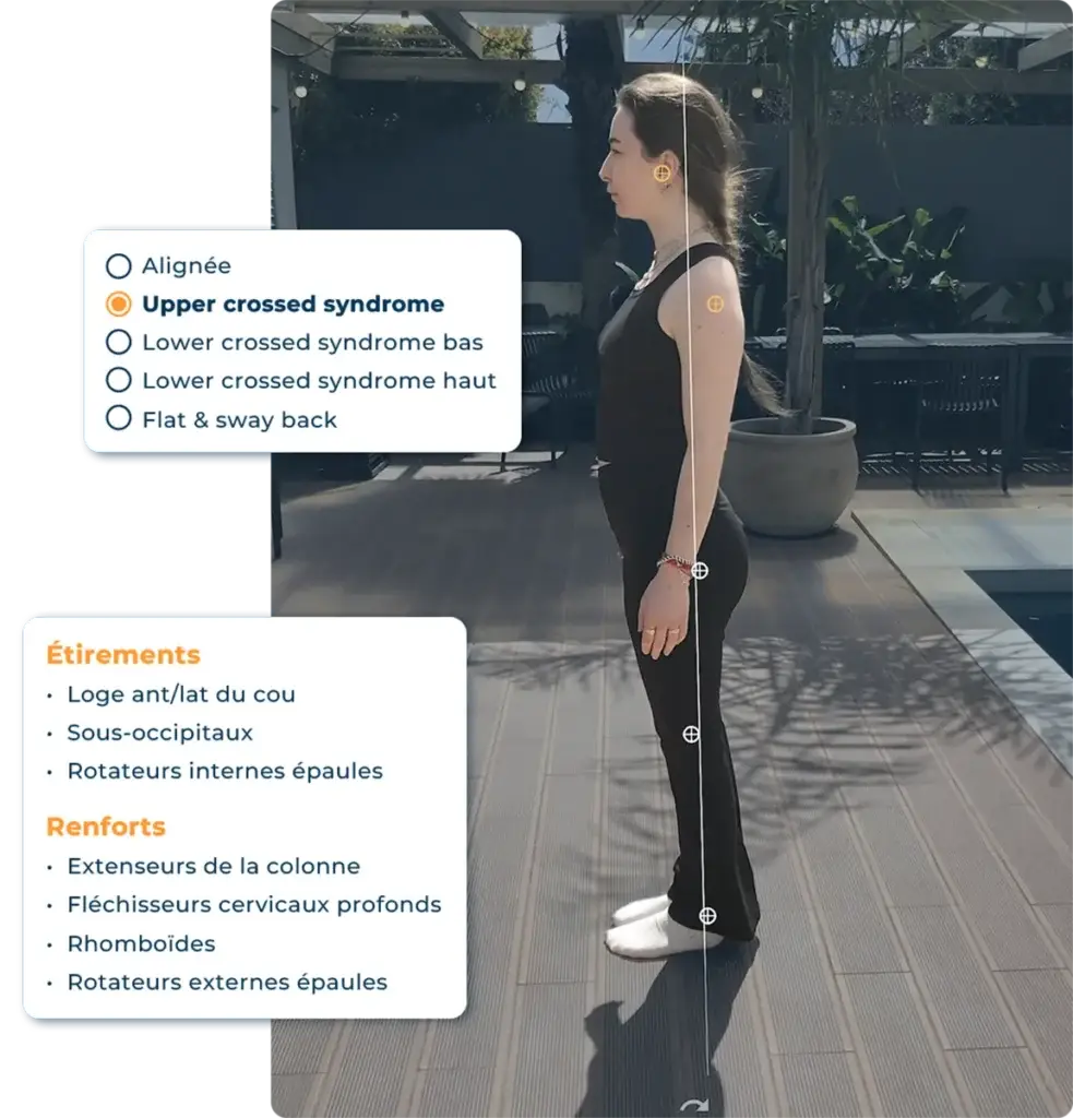Rapport d'analyse posturale Hexfit Lab généré avec Biotonix, identifiant un syndrome croisé supérieur avec les étirements et renforts recommandés